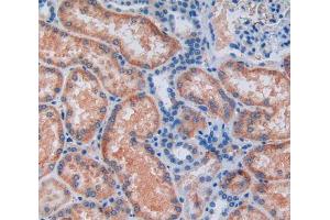 Used in DAB staining on fromalin fixed paraffin- embedded kidney tissue (ALDH7A1 抗体  (AA 1-539))