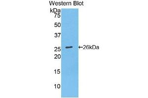 Western blot analysis of recombinant Mouse Bcl2. (Bcl-2 抗体  (AA 2-208))