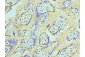 Immunohistochemistry of paraffin-embedded human placenta tissue using ABIN7171018 at dilution of 1:100 (ST14 抗体  (AA 566-855))