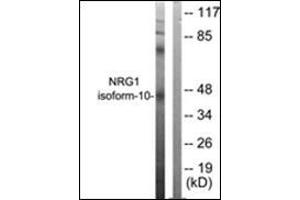 Western blot analysis of extracts from SKOV3 cells, using NRG1 isoform-10 Antibody. (Neuregulin 1 抗体  (Isoform 10, N-Term))