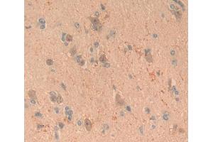 Used in DAB staining on fromalin fixed paraffin- embedded brain tissue (CRABP1 抗体  (AA 2-137))