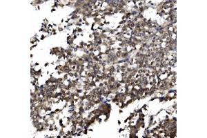 IHC analysis of TORC1/CRTC1 using anti-TORC1/CRTC1 antibody (ABIN7602801).