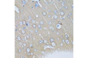 Immunohistochemistry of paraffin-embedded mouse brain using VSNL1 antibody.