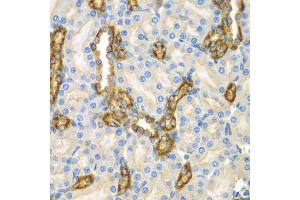 Immunohistochemistry of paraffin-embedded mouse kidney using CNPY3 antibody (ABIN5975491) at dilution of 1/100 (40x lens). (TNRC5 抗体)