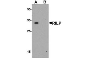 Western blot analysis of RILP in A20 cell lysate with RILP antibody at 1 ug/mL. (RILP 抗体  (Middle Region))