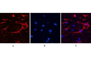Immunofluorescence analysis of rat brain tissue. (GFAP 抗体)