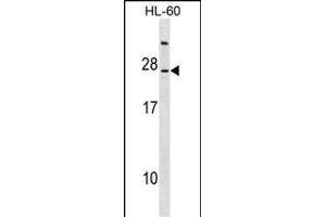 LY96 Antibody (C-term) (ABIN1536634 and ABIN2849030) western blot analysis in HL-60 cell line lysates (35 μg/lane). (LY96 抗体  (C-Term))