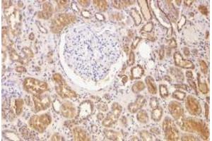 Immunohistochemistry (Paraffin-embedded Sections) (IHC (p)) image for anti-B-Cell CLL/lymphoma 2 (BCL2) (N-Term) antibody (ABIN499427)