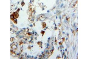 Used in DAB staining on fromalin fixed paraffin-embedded Lung tissue (Surfactant Protein C 抗体  (AA 24-197))