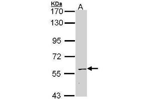 WB Image Sample (30 ug of whole cell lysate) A: Hep G2 , 7. (STAU1/Staufen 抗体  (C-Term))