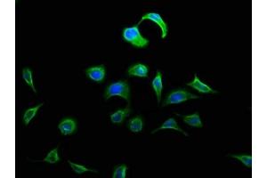 Immunofluorescence staining of A549 cells with ABIN7150574 at 1:133, counter-stained with DAPI. (DOK5 抗体  (AA 1-198))
