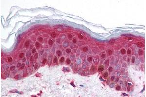 Human Skin (formalin-fixed, paraffin-embedded) stained with BRD2 antibody ABIN214728 at 5 ug/ml followed by biotinylated goat anti-rabbit IgG secondary antibody ABIN481713, alkaline phosphatase-streptavidin and chromogen. (BRD2 抗体  (AA 524-573))