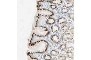 Immunohistochemical staining of human stomach with B4GALNT3 polyclonal antibody  shows strong cytoplasmic positivity in glandular cells. (B4GALNT3 抗体)
