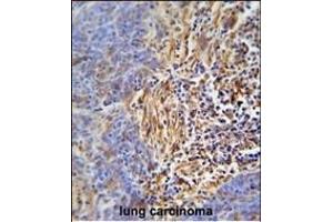 Immunohistochemistry (Paraffin-embedded Sections) (IHC (p)) image for anti-Major Histocompatibility Complex, Class II, DR beta 5 (HLA-DRB5) (AA 43-70) antibody (ABIN653782)