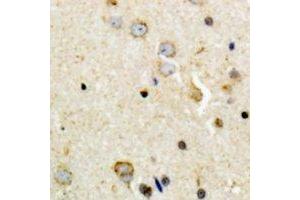 Immunohistochemical analysis of Tyrosine Hydroxylase (pS8) staining in human brain formalin fixed paraffin embedded tissue section. (Tyrosine Hydroxylase 抗体  (N-Term, pSer8))