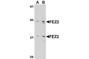 Western blot analysis of FEZ2 in 3T3 cell lysate with AP30335PU-N FEZ2 antibody at (A) 0. (FEZ2 抗体  (Center))