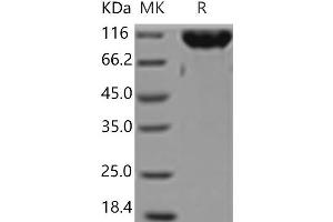 Western Blotting (WB) image for Colony Stimulating Factor 1 Receptor (CSF1R) (Active) protein (Fc Tag) (ABIN7321077) (CSF1R Protein (Fc Tag))