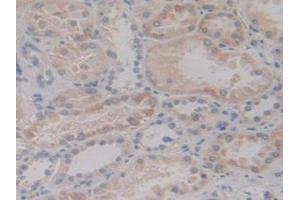 IHC-P analysis of Human Kidney Tissue, with DAB staining. (MAP2K6 抗体  (AA 46-306))
