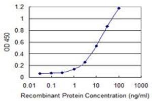 Detection limit for recombinant GST tagged ETNK1 is 0. (Ethanolamine Kinase 1 抗体  (AA 133-228))