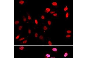 Immunofluorescence analysis of U2OS cells using RAD18 Polyclonal Antibody (RAD18 抗体)