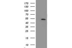 Western Blotting (WB) image for anti-Amyloid beta (A4) Precursor Protein-Binding, Family B, Member 3 (APBB3) antibody (ABIN1496653) (APBB3 抗体)