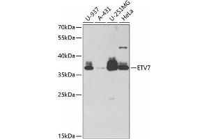 Western blot analysis of extracts of various cell lines, using ETV7 antibody (ABIN6132177, ABIN6140336, ABIN6140338 and ABIN6221858) at 1:1000 dilution. (ETV7 抗体  (AA 1-210))