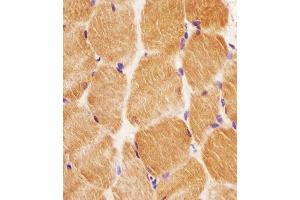 B staining GCLM in human skeletal muscle tissue sections by Immunohistochemistry (IHC-P - paraformaldehyde-fixed, paraffin-embedded sections). (GCLM 抗体  (C-Term))