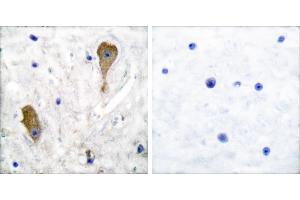 Peptide - +Immunohistochemical analysis of paraffin-embedded human brain tissue using GAD67 antibody. (GAD 抗体)
