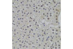Immunohistochemistry of paraffin-embedded mouse liver using HNRNPA1 Antibody (ABIN5975570) at dilution of 1/100 (40x lens). (HNRNPA1 抗体)