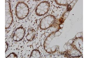 Immunostaining (ISt) image for anti-serine/threonine Kinase 17b (STK17B) (AA 272-372) antibody (ABIN564000)