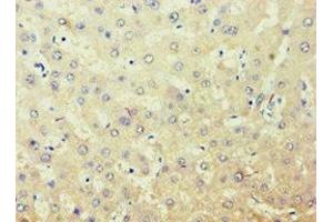 Immunohistochemistry of paraffin-embedded human liver tissue using ABIN7143588 at dilution of 1:100 (AKR7A3 抗体  (AA 1-331))