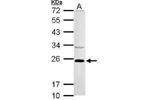 WB Image VHL antibody detects VHL protein by Western blot analysis. (VHL 抗体)
