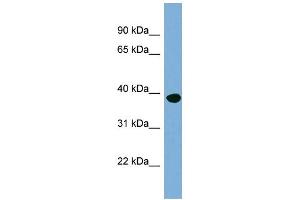 WB Suggested Anti-OAS1 Antibody Titration:  0. (OAS1 抗体  (N-Term))
