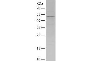 Western Blotting (WB) image for Glutamate-Cysteine Ligase, Catalytic Subunit (GCLC) (AA 1-218) protein (His-IF2DI Tag) (ABIN7123113) (GCLC Protein (AA 1-218) (His-IF2DI Tag))