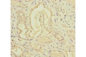 Immunohistochemistry of paraffin-embedded human kidney tissue using ABIN7159656 at dilution of 1:100 (MMACHC 抗体  (AA 63-282))