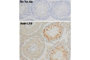 Immunohistochemistry (IHC) image for anti-Interleukin 10 (IL10) antibody (ABIN6254177) (IL-10 抗体)