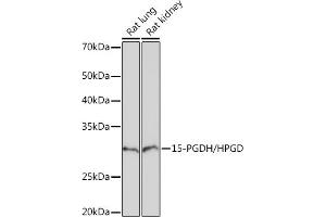 Western blot analysis of extracts of various cell lines, using 15-PGDH/HPGD Rabbit mAb (ABIN7267807) at 1:1000 dilution. (HPGD 抗体)