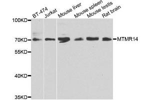Western blot analysis of extracts of various cell lines, using MTMR14 antibody. (MTMR14 抗体)