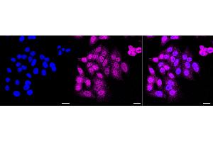 Immunocytochemical staining of HepG2 cells with BAG cochaperone 3 antibody (ABIN7800911), 1:1,000). (Recombinant BAG Cochaperone 3 抗体)
