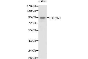 PTPN22 抗体  (AA 1-90)