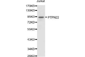 Western blot analysis of extracts of Jurkat cell lines, using PTPN22 antibody. (PTPN22 抗体  (AA 1-90))