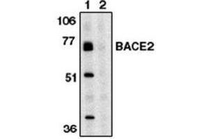 Image no. 1 for anti-beta-Site APP-Cleaving Enzyme 2 (BACE2) (AA 496-511) antibody (ABIN264997) (BACE2 抗体  (AA 496-511))
