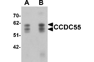 Western blot analysis of CCDC55 in human brain tissue lysate with CCDC55 antibody at (A) 0. (NSRP1 抗体  (C-Term))