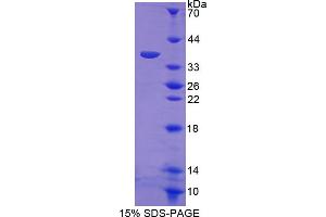 SDS-PAGE analysis of Mouse RELA Protein. (NF-kB p65 蛋白)