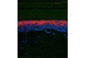 rat and mouse brain (SMAD2 抗体  (N-Term))