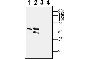 1-2. (Adiponectin Receptor 1 抗体  (Intracellular, N-Term))