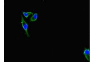 Immunofluorescent analysis of Hela cells using ABIN7156691 at dilution of 1:100 and Alexa Fluor 488-congugated AffiniPure Goat Anti-Rabbit IgG(H+L) (IFITM5 抗体  (AA 1-36))