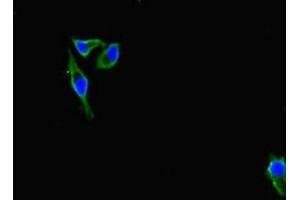 Immunofluorescent analysis of Hela cells using ABIN7156691 at dilution of 1:100 and Alexa Fluor 488-congugated AffiniPure Goat Anti-Rabbit IgG(H+L)