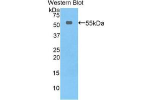 Western Blotting (WB) image for anti-Thymidine Phosphorylase (TYMP) (AA 33-290) antibody (ABIN3207502) (Thymidine Phosphorylase 抗体  (AA 33-290))