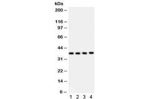 Western blot testing of 1) human placenta, 2) HeLa, 3) HUT and 4) Jurkat lysate with PINX1 antibody. (PINX1 抗体)